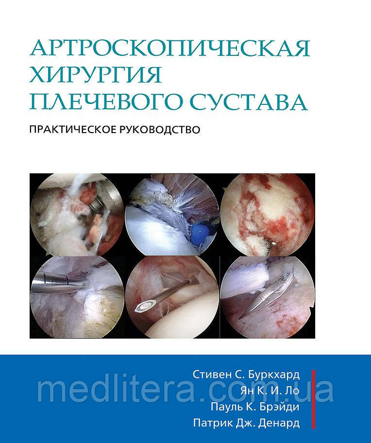 Стівен С. Буркхард, Артроскопічна хірургія плечового суглоба. Практичне керівництво