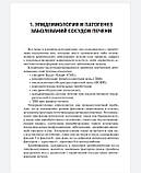 Павлів. Захворювання судин печінки. Підхід до терапії, фото 5