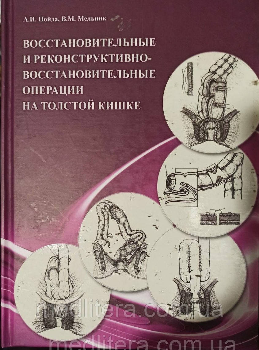 Пойда А. В. Відновлювальні та реконструктивно-відновні операції на товстій кишці