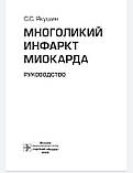Якушин. Багатоликий інфаркт міокарда. Інструкція, фото 3