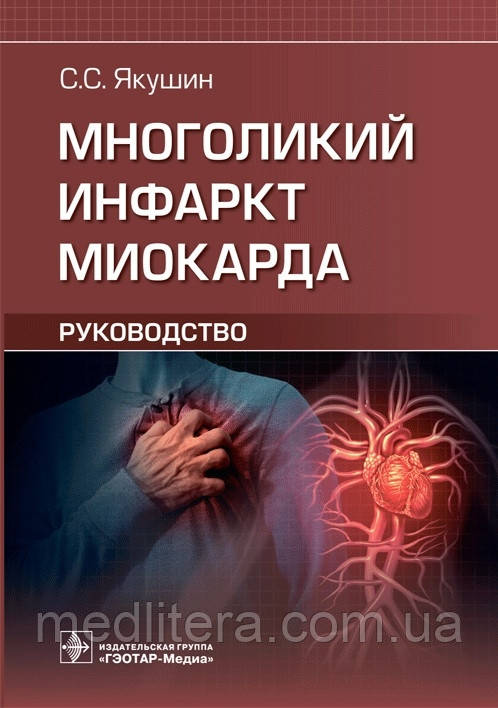 Якушин. Багатоликий інфаркт міокарда. Інструкція