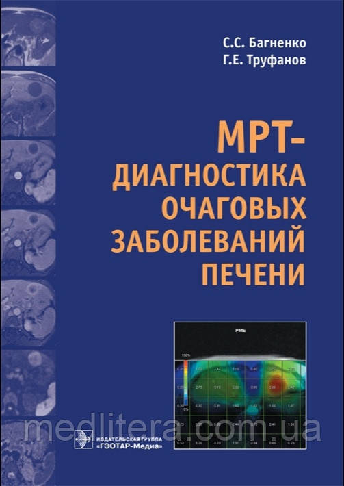 Багненко С., Труфанів Г. МРТ-діагностика осередкових захворювань печінки