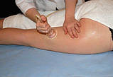 Апарат вакуумного масажу IM-818 для обличчя та тіла (без банок), фото 9