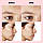 Напівпрозорі мікроигли проти акне прищів накладки для видалення майстер шкіри обличчя заспокійливий лікувальний, фото 4