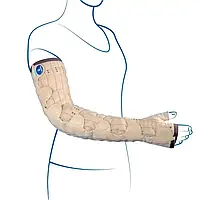 Компресійний рукав для лікування лімфемфедеми Mobiderm Autofit Thuasne