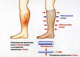 Гольфи компрессійні