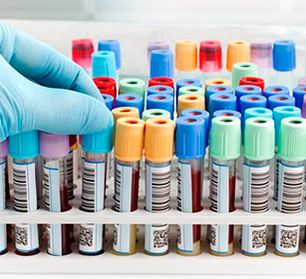 Системи забору крові