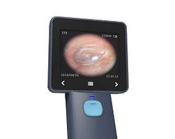 Портативний відеоотоскоп BD-OU USB