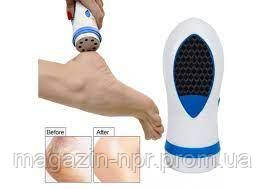 Набір для педикюру електрична пемза Pedi Spin Педі Спін для догляду за ступнями, пемза для ніг spn