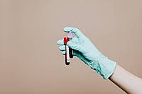 Процес забору крові з вени з допомогою вакуумних пробірок