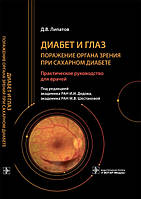 Ліпатів. Дідів. Діабет та очей. Ураження органа зору у разі цукрового діабету