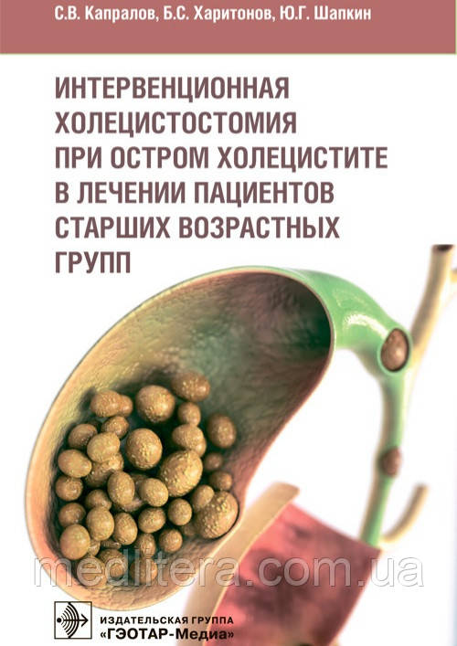 Капралів Інтервенційна холецистомія у разі гострого холециститу в лікуванні пацієнтів старших вікових груп