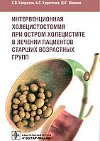 Капралів Інтервенційна холецистомія у разі гострого холециститу в лікуванні пацієнтів старших вікових груп
