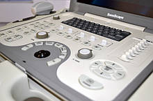 Апарати УЗД Sonoscape Ultrasound Machines