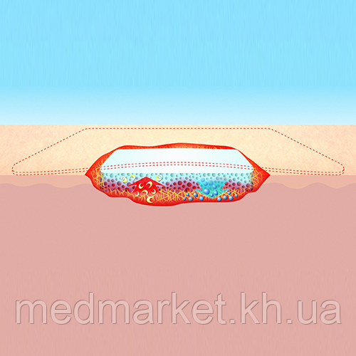 Повязка раневая с натуральным коллагеном SUPRASORB С 8х12х0,8 см - фото 4 - id-p883648787