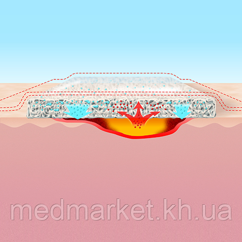 Повязка биосинтетическая Suprasorb X HydroBalance 9х9 см (5 шт/уп) - фото 4 - id-p978740792