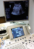 Ультразвуковий сканер для клінічної діагностики УЗД GE Logiq 9 USG Color 3D Ultrasonograf, фото 4