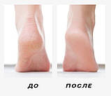 Електрична пемза для ніг Callus remover vacuum Focallure WM-47-S1  для чищення п'ят і видалення мозолів 2000, фото 7