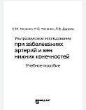Ультразвукове дослідження при захворюваны артерій і вен нижніх кінцівок Носенко Дадова, фото 2