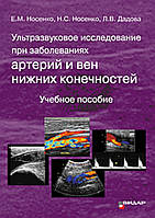 Ультразвуковое исследование при заболеваниях артерий и вен нижних конечностей. Носенко. Дадова
