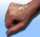 Cica Care 12х15см - Силіконовий пластир від рубців і шрамів, фото 3