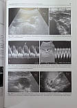 Капустін Ультразвукове дослідження в урології і нефрології, фото 8