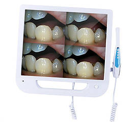 Інтраоральна камера з монітором WiFi ТВ тюнер