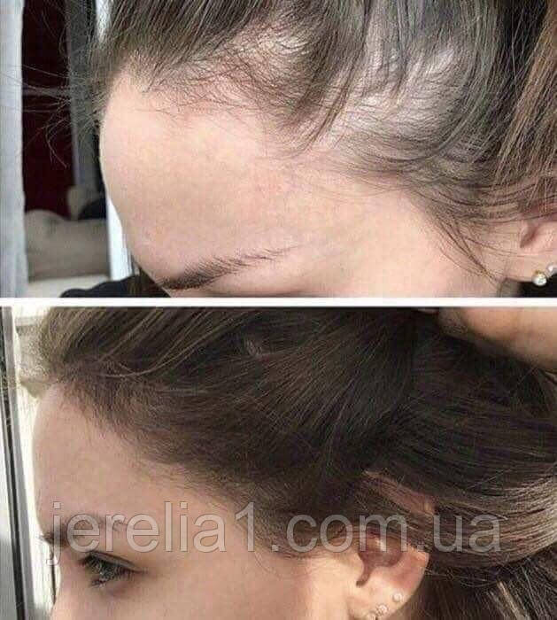 Комплекс проти випадіння волосся Hair System, Джерелія, фото 1