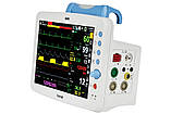 Монітор приліжковий BM5 (EtCO2, ІАД), фото 3