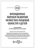 Вроджені вади розвитку щелепно-лицьової зони в дітей. Навчальний посібник. Топельницького, А.П. Гургенадзе, фото 3