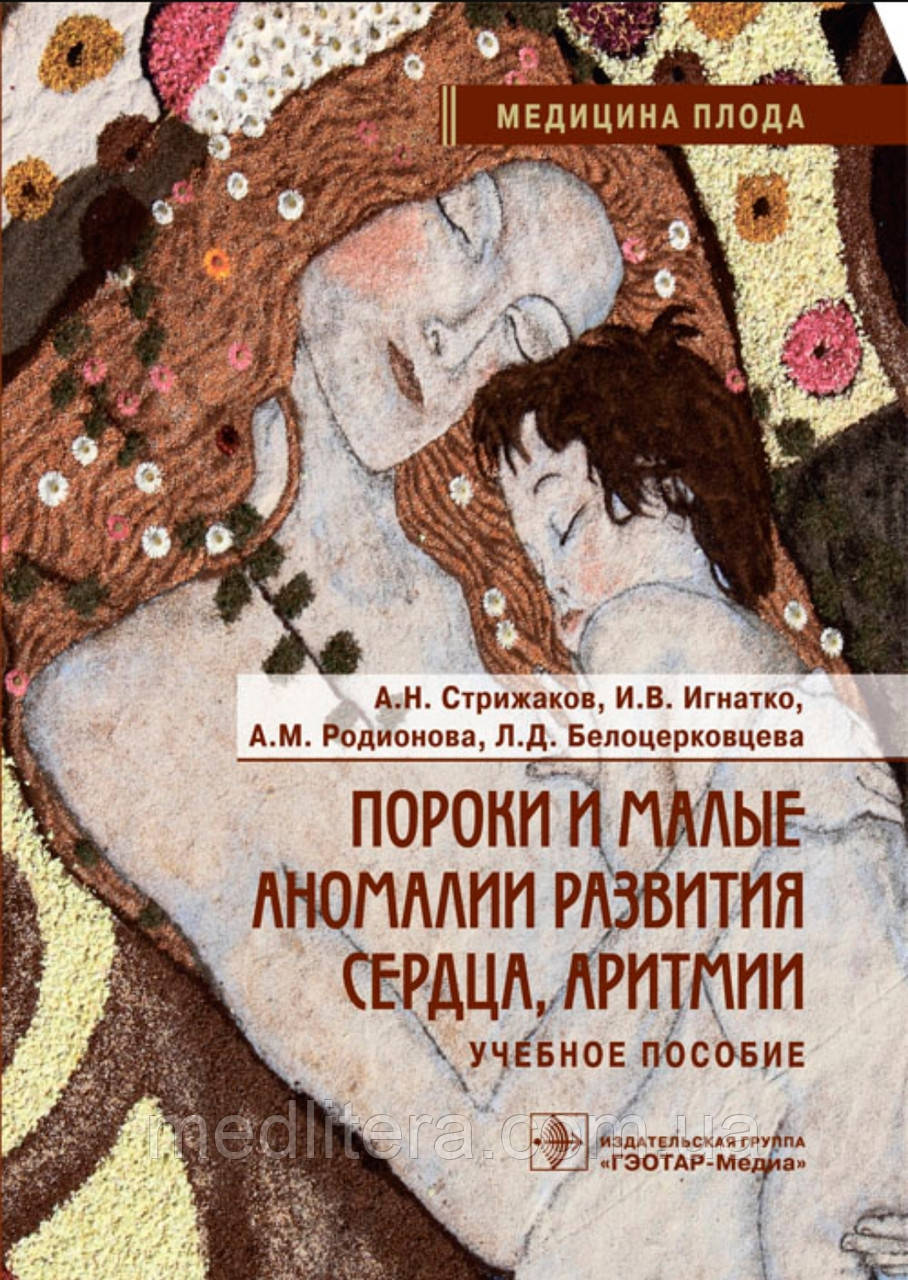 Пороги та малі аномалії розвитку серця, аритмії. Стрижаків А.Н., Ігнатко І.В., Родіонова А.М.