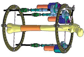 Аппарат внешней фиксации Илизарова (Гудермес)