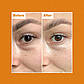 Крем для очей від темних кіл Ren Brightening Dark Circle Eye Cream 15 мл, фото 2