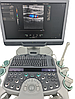 Siemens S2000 HELX (2015) КАРДІО преміум + 4 датчики Апарат УЗІ 3D і 4D з кольоровим доплером, еластографією, фото 10