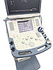 Зуби апарат Toshiba Xario XG (SSA-680A) + лінійний датчик Ультразвуковий сканер експертного класу, фото 8