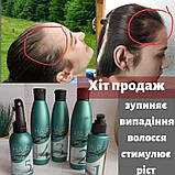 Комплекс проти випадіння волосся Hair System, фото 10