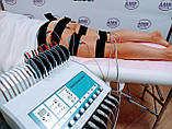 Апарат міостимуляції MIO MAX, апарат для схуднення, нарощування м'язової маси, реабілітація, фото 6