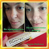 Масажний протинабряковий ролик для шкіри навколо очей, фото 8