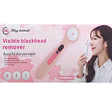 Вакуумний прилад для чищення обличчя Visible Blackhead Remover, фото 2