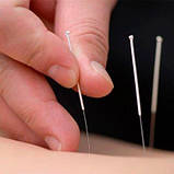 Стерильні голки для акупунктури 0,30 х 40 (1000 шт.), SAN-30-40-1000, фото 4