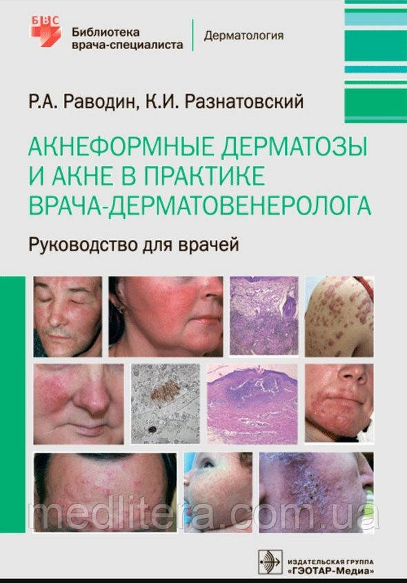 Раводін Р.А., Розтавський К.І. Акнеформні дерматози й акне в практиці лікаря-дерматовенеролога. Інструкція