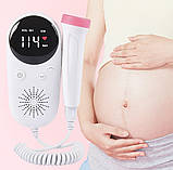 Доплер фетальный для беременных Аппарат домашний для измерения биения сердца ребенка Medset LittleOne L1, фото 3