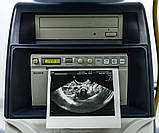 Апарат УЗД для інтенсивної клінічної практики GE Voluson S8 Ultrasonograf, фото 4