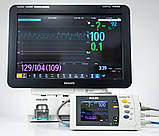 Б/У Монітор пацієнта Philips IntelliVue MX800 Patient Monitor + Philips IntelliVue X2 Used, фото 3