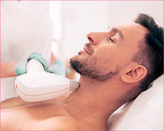 Лазерна епіляція шиї (чоловіки)