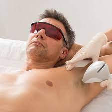 Лазерна епіляція для чоловіків