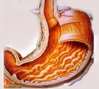 У разі захворювань шлунка (гастрит, виразкова хвороба)