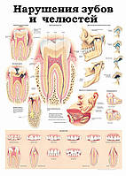 Нарушения зубов и челюстей - плакат
