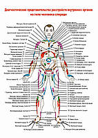 Диагностические представительства расстройств внутренних органов на теле человека спереди - плакат