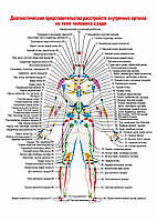 Диагностические представительства расстройств внутренних органов на теле человека сзади - постер
